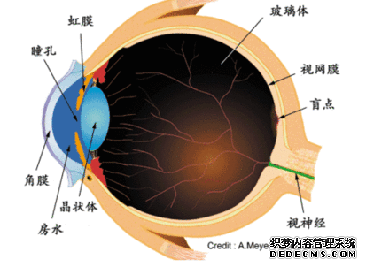 義眼適合什么樣的患者？